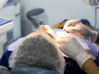 Chirurgia stomatologiczna