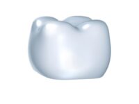 Korona tymczasowa wykonana w pracowni protetycznej