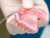 Podścielenie protezy