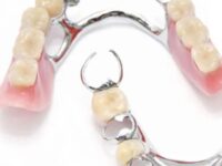 Proteza szkieletowa, akronowa, acetalowa