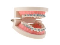 Modele diagnostyczne